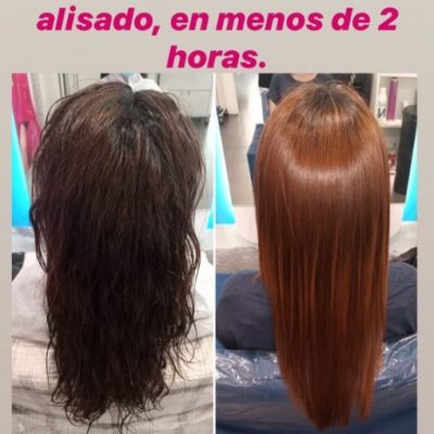 tratamiento-mujer (4)